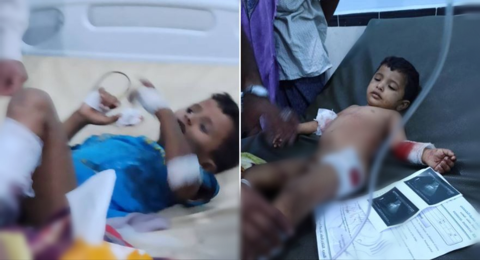 Yemeni government kills Shabwa children with Saudi weapons