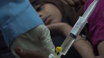 الأمم المتحدة: النظام الصحي لليمن انهار فعليًّا مع تفشي كورونا